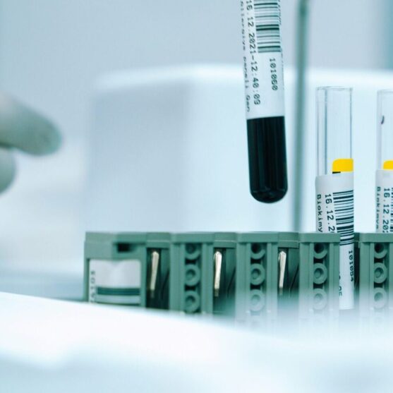 How Acaster Lloyd secured its legacy through a structured Employee Ownership exit in 10 months